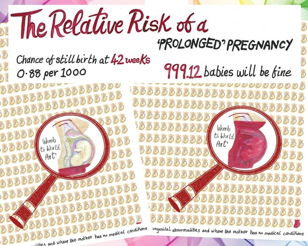 Prolonged Pregnancy Relative Risk Chart: 40 Weeks Overdue Birth Education PDF (Digital Download)