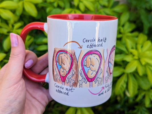 Soften and Open Cervical Dilation Mug | Birth Education | Doula Gift | Student Midwife | Pregnancy Mug | Birthworker