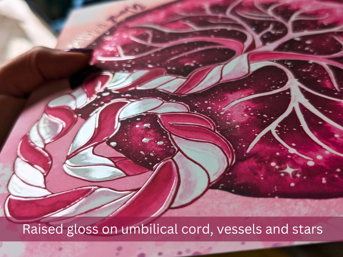 Luxury Placenta Art Print