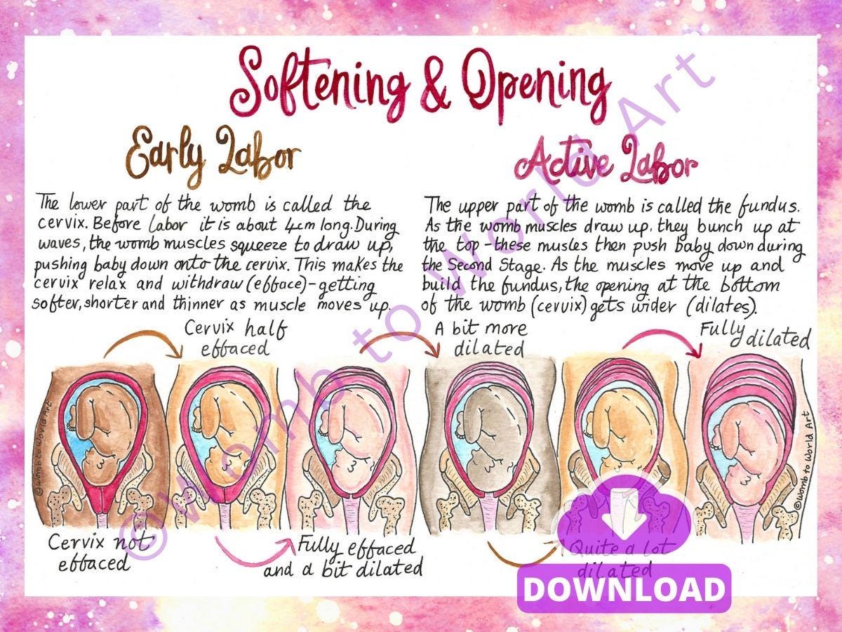 Hypnobirthing Cervical Dilation Handout: Labour Education Diagrams for Doulas and Antenatal (PDF Download)