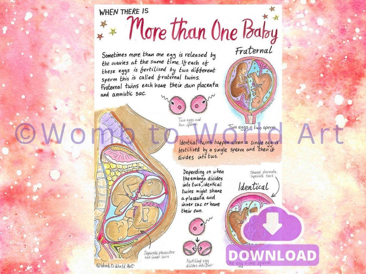 Twins Conception A4 Handout PDF Download | Antenatal Education | Doula | Midwife | Pregnancy Anatomy
