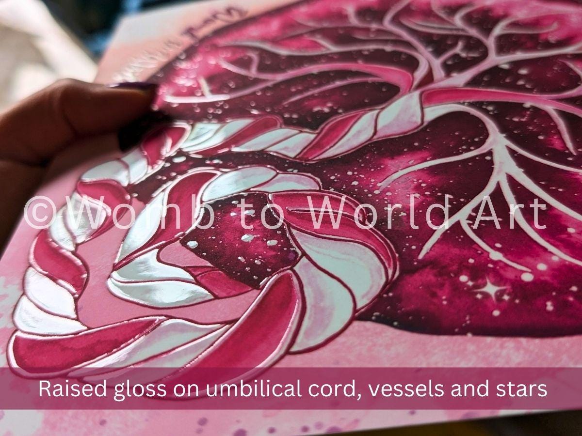 Luxury Placenta Art Print