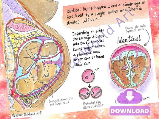 Twins Conception A4 Handout PDF Download | Antenatal Education | Doula | Midwife | Pregnancy Anatomy