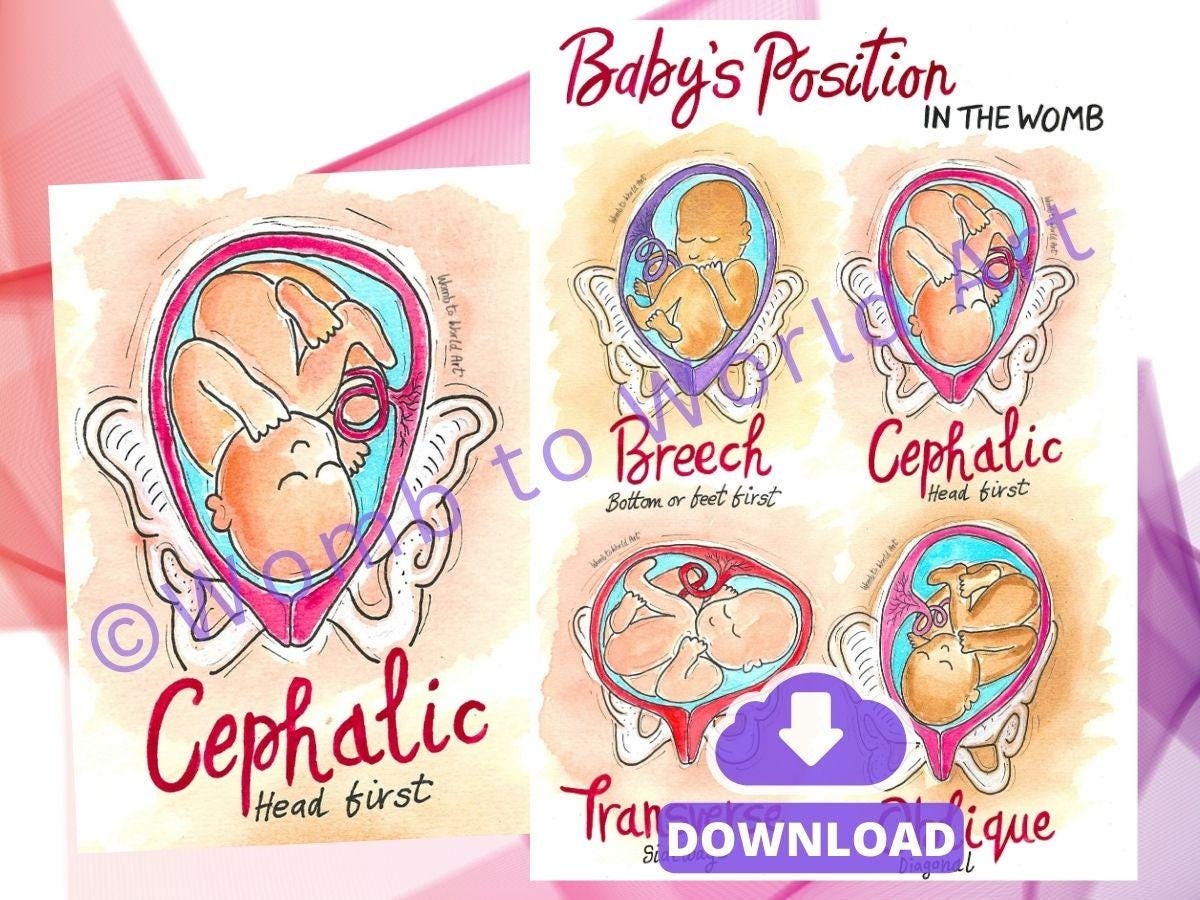 Fetal Baby Womb Positions Print: Antenatal Education Handout (PDF Download)
