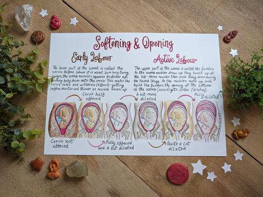 Hypnobirthing Cervical Dilation Handout: Labour Education Diagrams for Doulas and Antenatal (PDF Download)