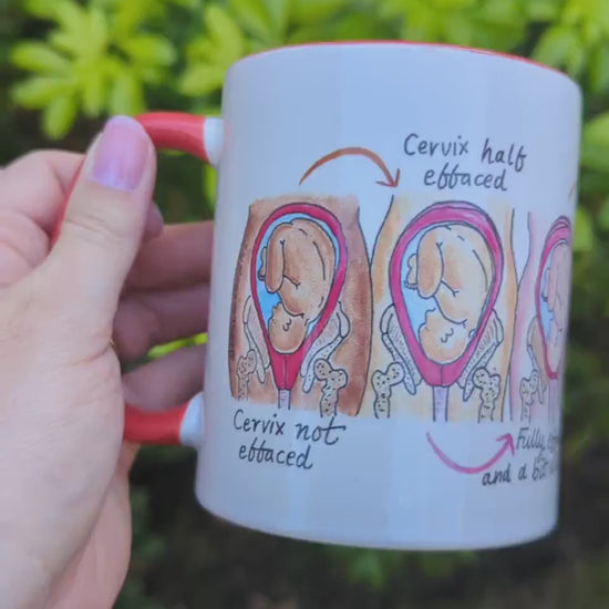 Soften and Open Cervical Dilation Mug